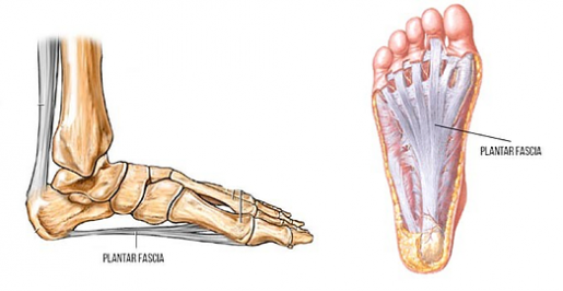 Plantar Fasciitis - The Foot People