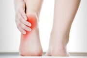 A woman with plantar fascitiis irritation holds the bottom of her foot